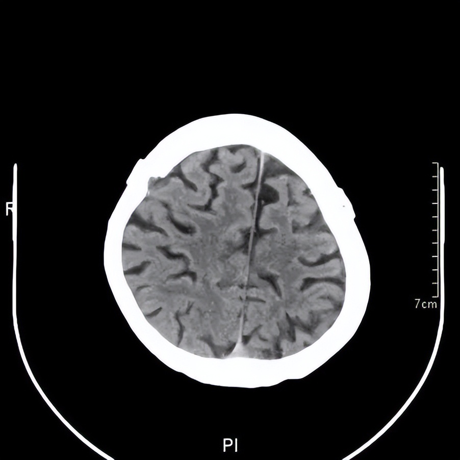 记忆门诊深圳,记忆门诊诊疗流程