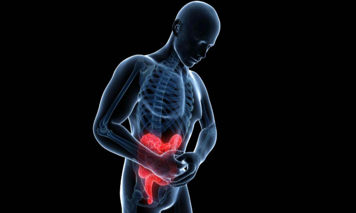 烧心食物,烧心食物禁忌