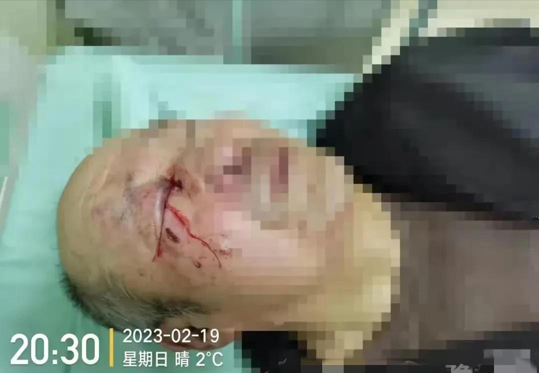 23年，73岁老兵被养老院护工打爆眼球，院方：我们是日本管理理念