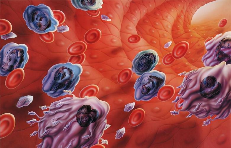 李开复抗癌成功过程,李开复抗癌从癌症到肿瘤消失9年