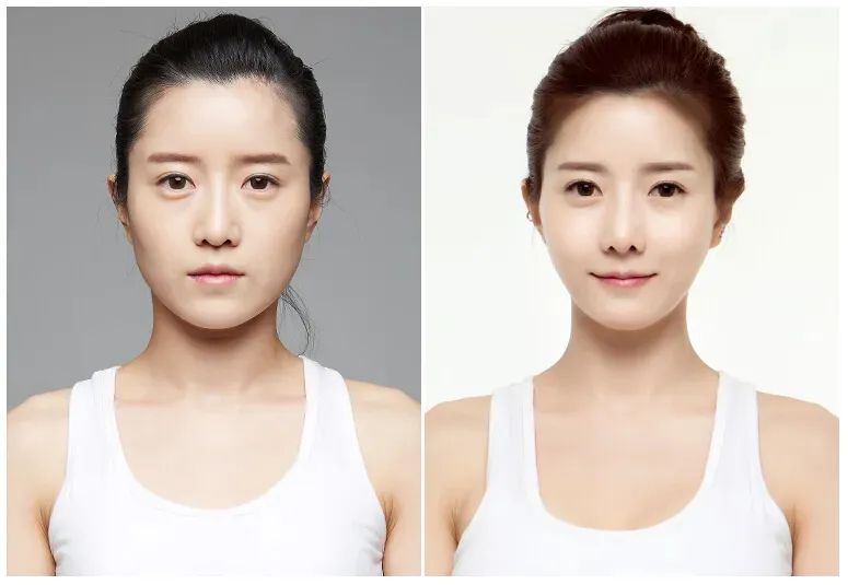 怎样能改善脸型塑造小v脸,大脸小v脸怎么变小