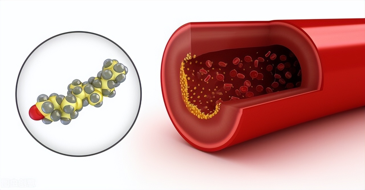 体检报告上常见的30个指标,体检报告有三颗星代表什么