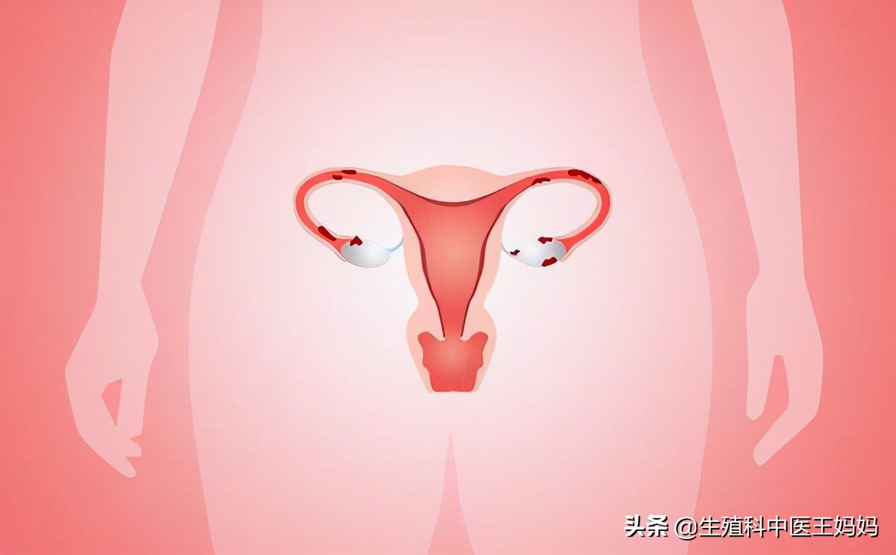 它被称为妇科美容方,医圣亲自拟方,可调难缠的两大妇科病