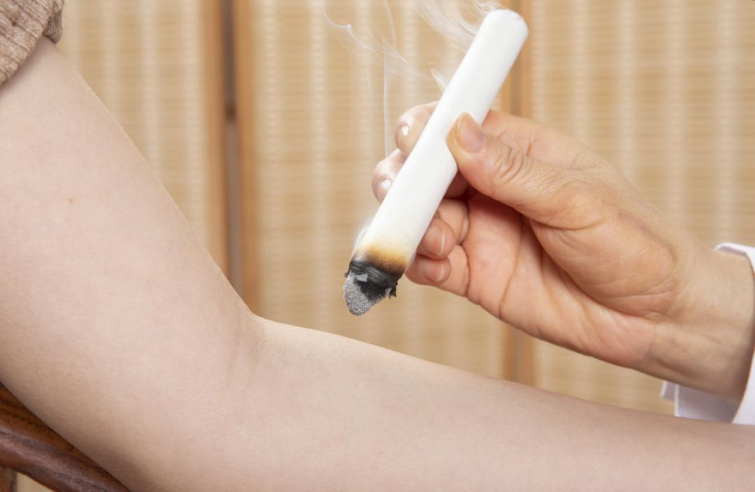 三九灸儿童,小孩可以三九灸吗