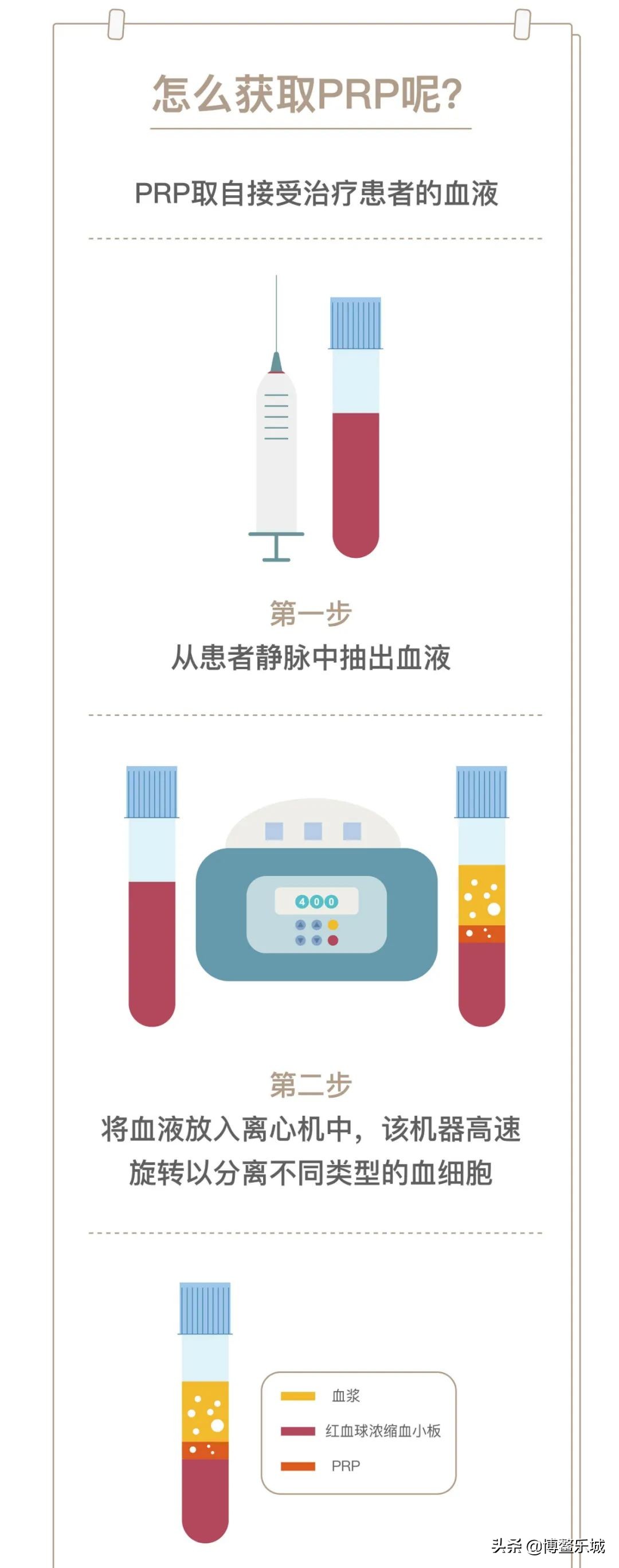 无需手术，乐城颖奕PRP注射治疗让深受膝关节炎苦痛多年的患者告别了轮椅……