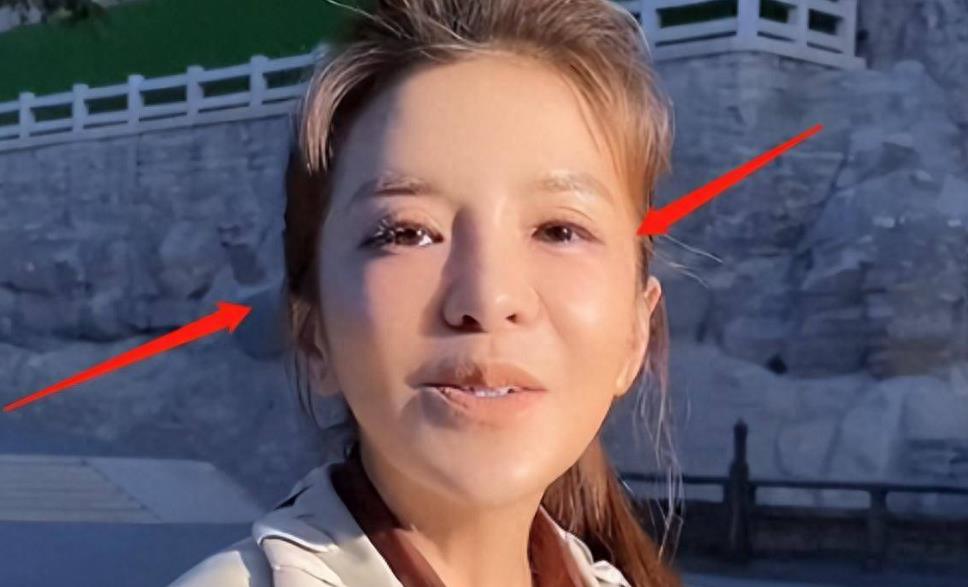 央视朱迅曾患什么病,主持人朱迅患病治好了吗