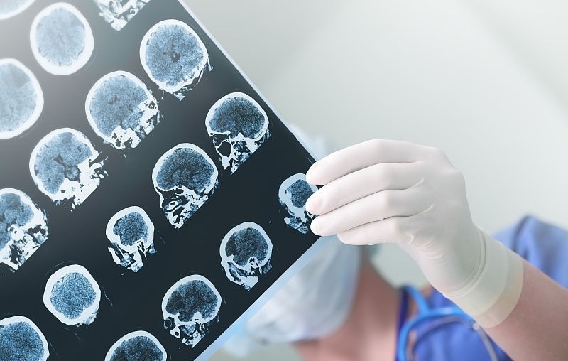 妹妹瘫痪在床20年监控下的一幕,河北一女孩假装瘫痪二十年