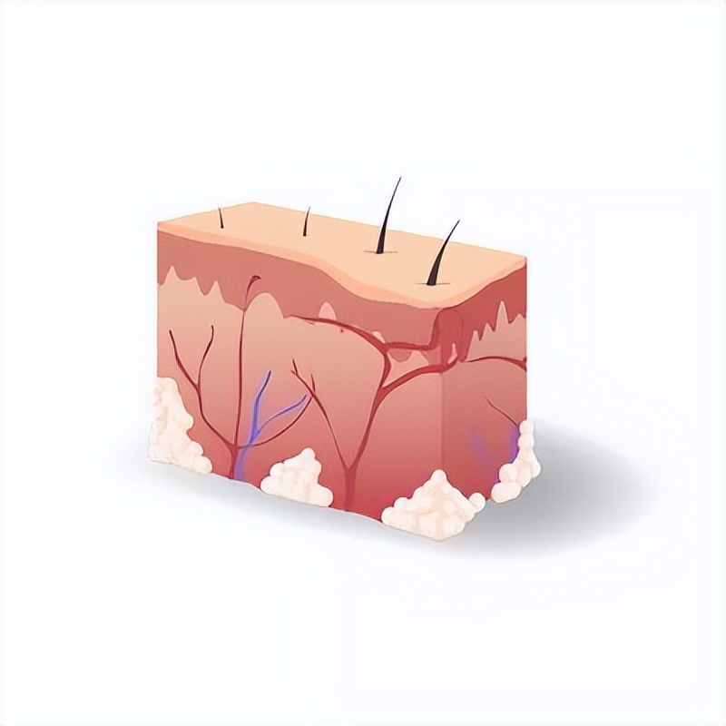 毛孔越来越粗大是什么原因导致的,毛孔越来越粗大怎么处理