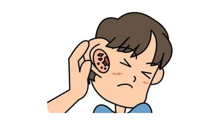 如何预防外耳炎复发,容易被忽视的严重病