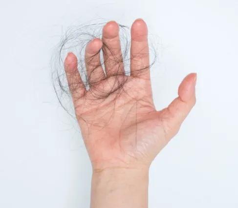 宝妈生完孩子四个月掉头发严重,剖腹产三个月脱发非常严重怎么办