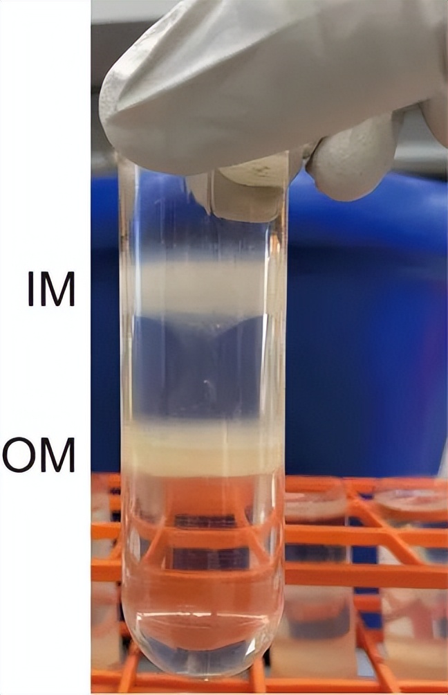纯化大肠杆菌的三种方法,纯化大肠杆菌的四种方法