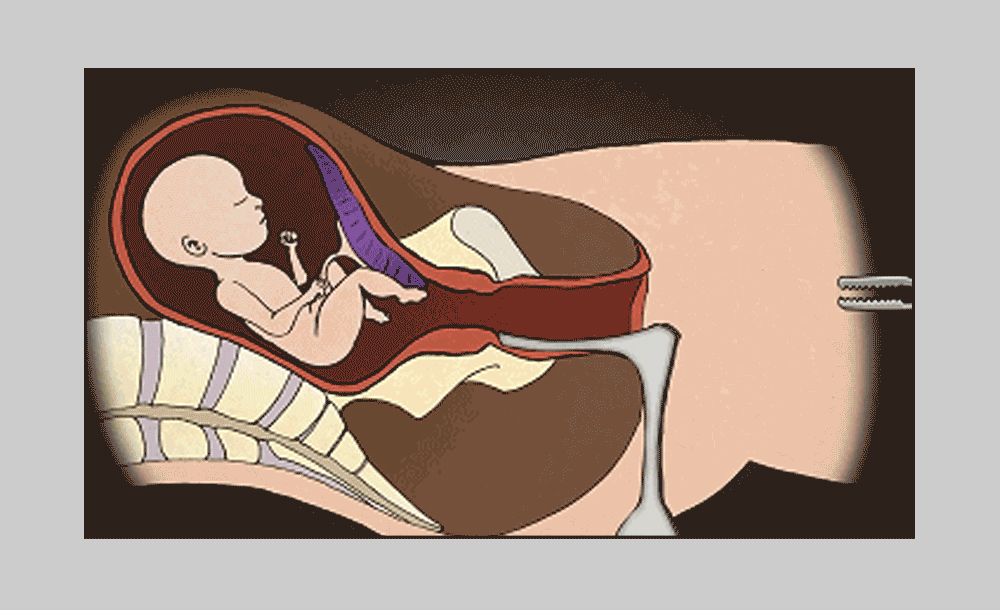 为什么女生在安全期也会怀孕,为什么女性会意外怀孕