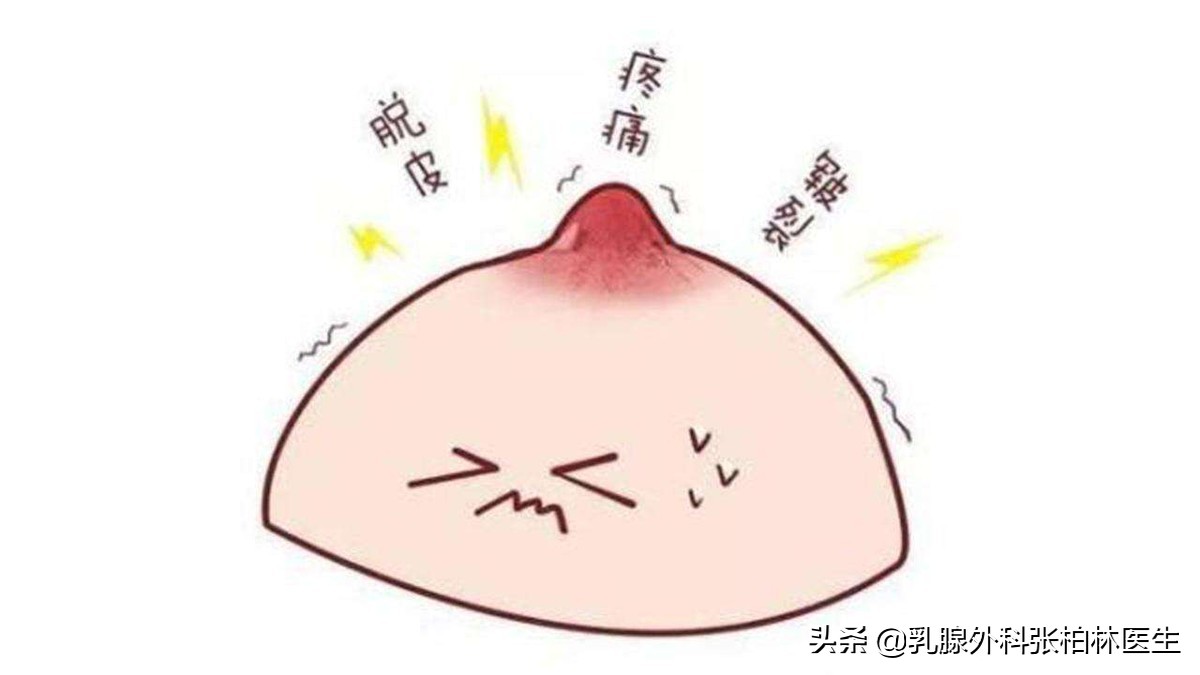 乳腺管阻塞会导致乳腺炎吗？乳腺炎吃什么药？