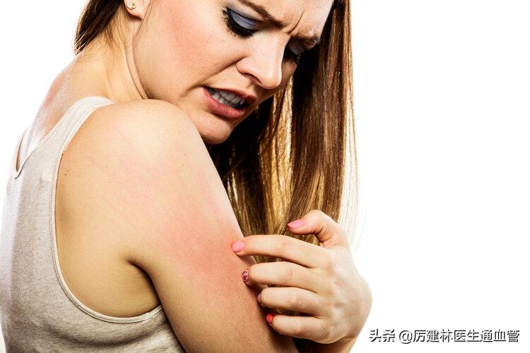 红霉素眼膏和红霉素软膏区别在哪,红霉素软膏和红霉素眼膏有啥区别