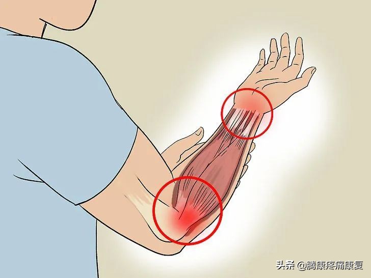 前臂桡侧疼痛怎么缓解,前臂疼痛按摩如何缓解