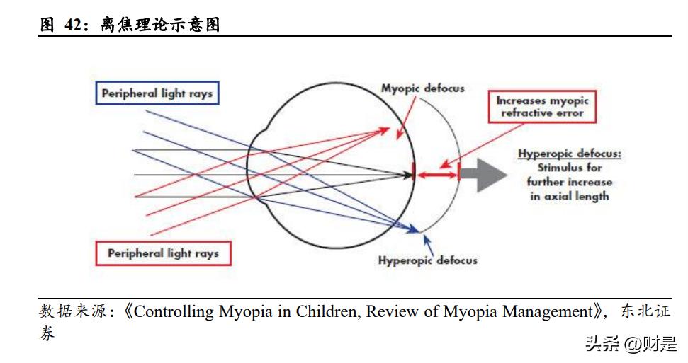 爱博医疗核心产品前景,爱博医疗最新报告