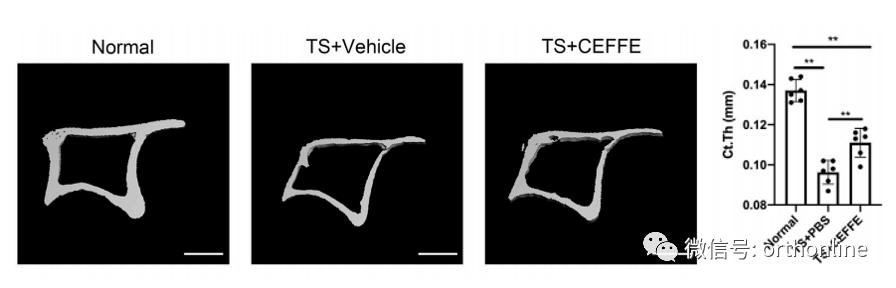 无细胞脂肪活性蛋白预防骨质疏松研究