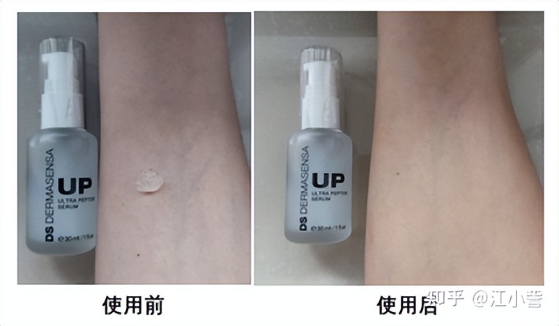 抗衰祛皱纹逆龄变美,紧致抗衰淡法令纹的项目