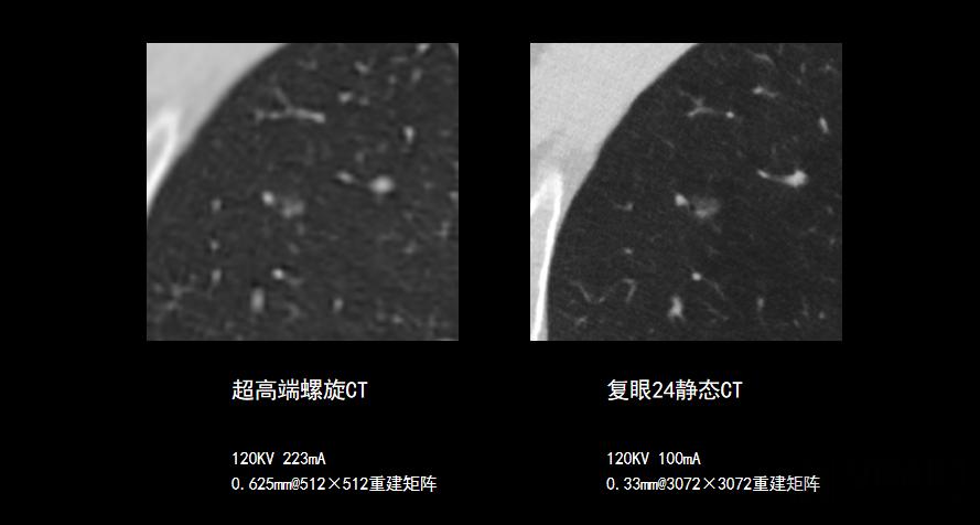 超高端ct性能参数,超高端ct多久出结果