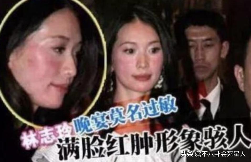 天生没子宫对口水过敏的明星,天生没子宫对口水过敏