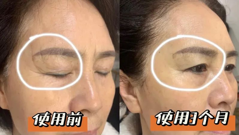 欧莱雅复颜抗皱水乳套装短视频,欧莱雅抗皱紧致水乳套装女