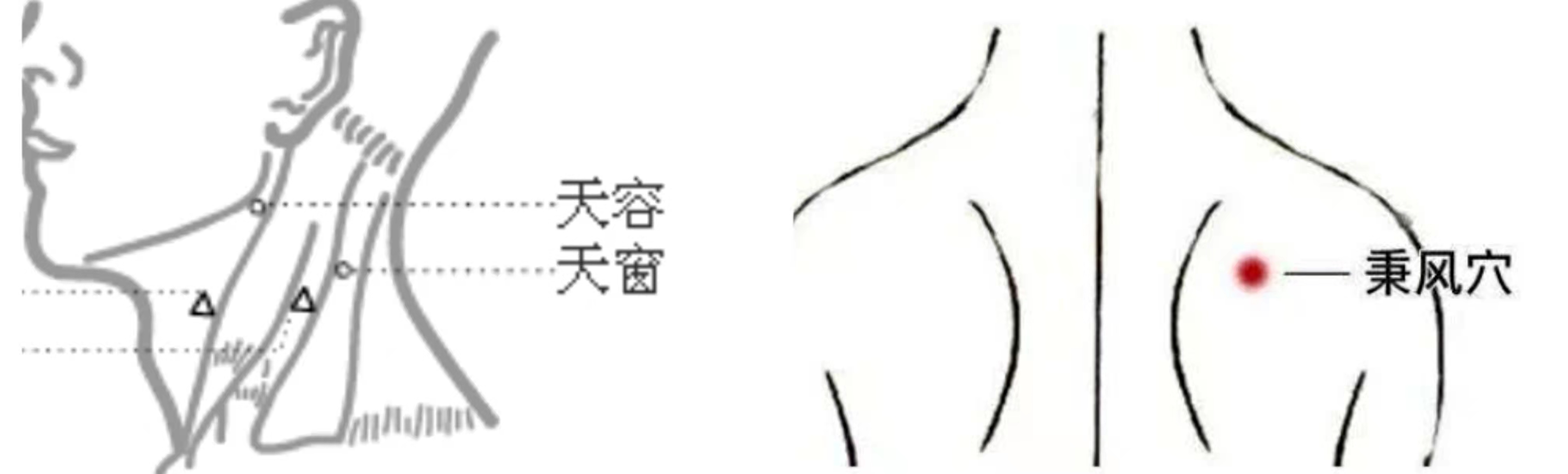 得了肩周炎吃什么药治疗效果最好,肩周炎针灸治疗最好最有效的穴位