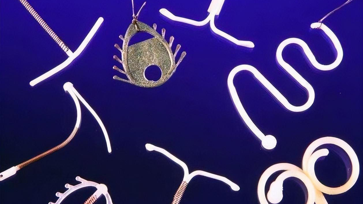 节育环一直不取会怎么样,节育环20多年尾丝会长在肉里面吗