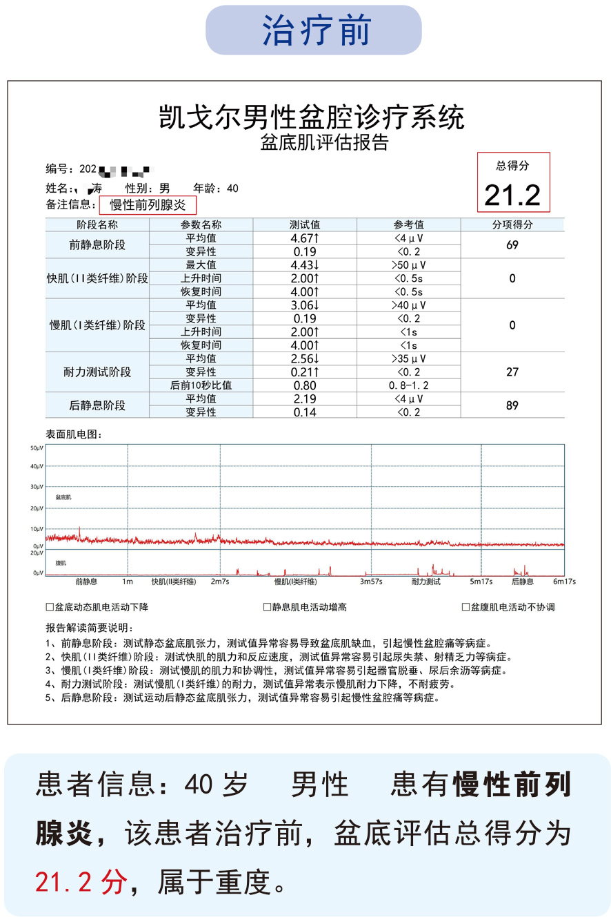 男性锻炼盆底肌的功效与作用,男性盆底肌群锻炼器材