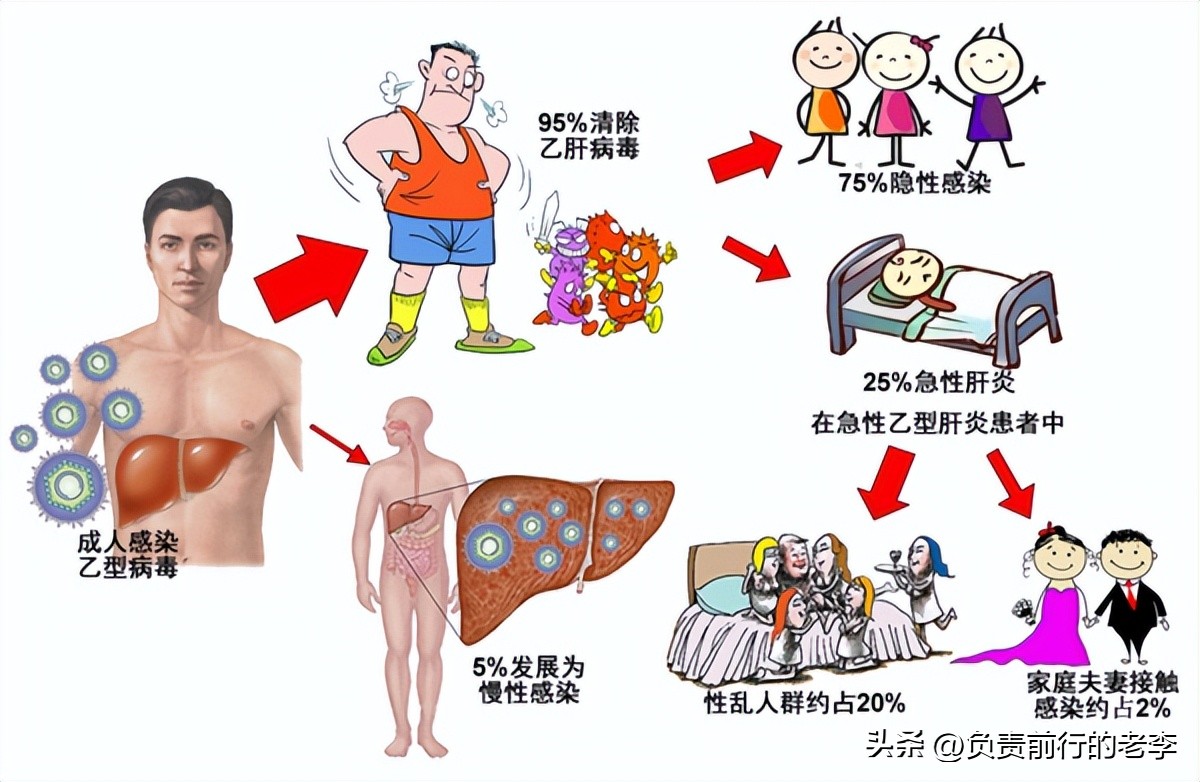 乙肝治愈新曙光,乙肝治愈新突破