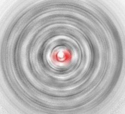 站起来眼前发黑是怎么回事怎么治,站起时眼前发黑是什么原因