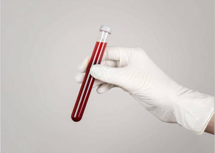 一喝水就尿多肾脏是好还是不好,一喝水就尿多说明肾脏好还是不好