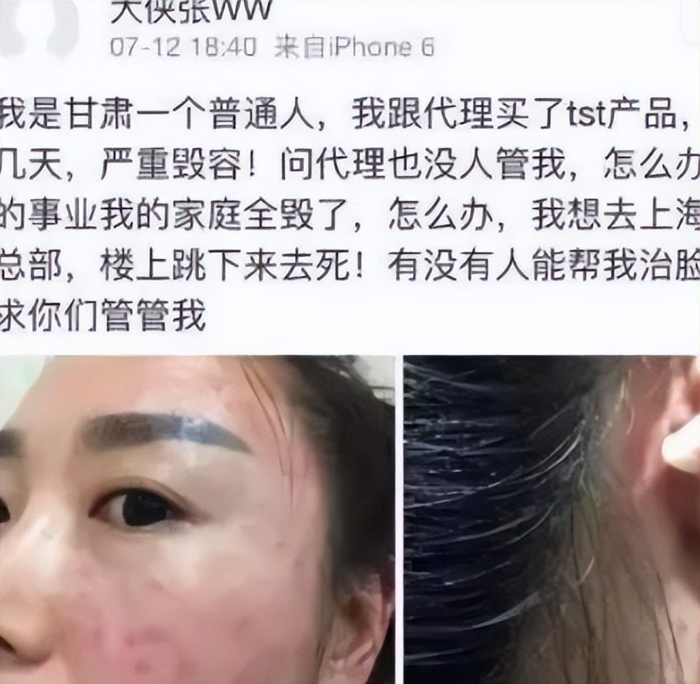 张庭夫妇开始做微商多少年,张庭和她的微商王国