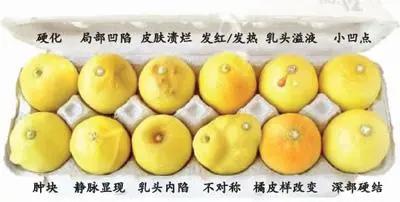 如果没有这个现象，乳房一大一小是正常的