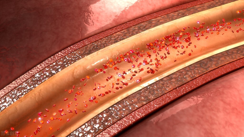 十几年失眠心脏扑通扑通跳,冠心病失眠中医案例