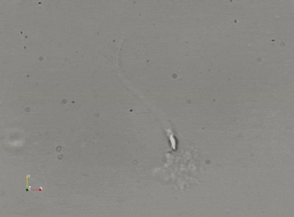 冻住精子！第一个靠谱的男性避孕药来了？