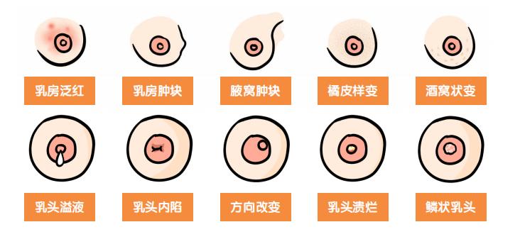 【胖熊医生谈肿瘤防治】如何做好乳腺癌预防、筛查、治疗及康复？乳腺科主任曾晓华编了一本科普图书