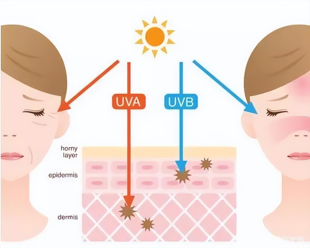 怎么让脸部红血丝变得又干净又白,怎样改善红血丝脸部
