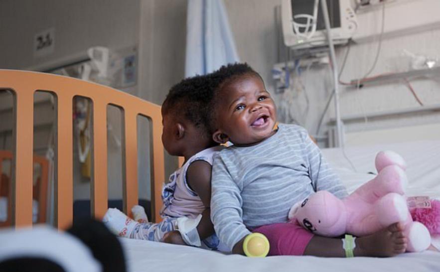 邦克兄弟连体人,连体人怎么进行生育