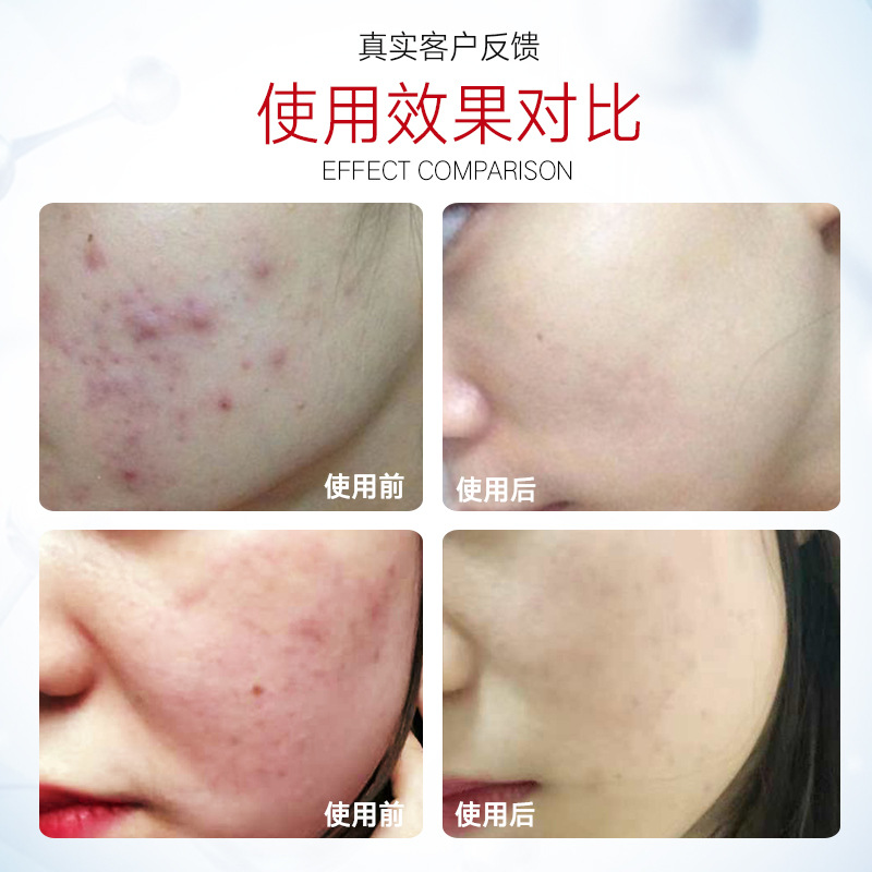 想抗老吃什么好,想抗老又想美白用什么面霜