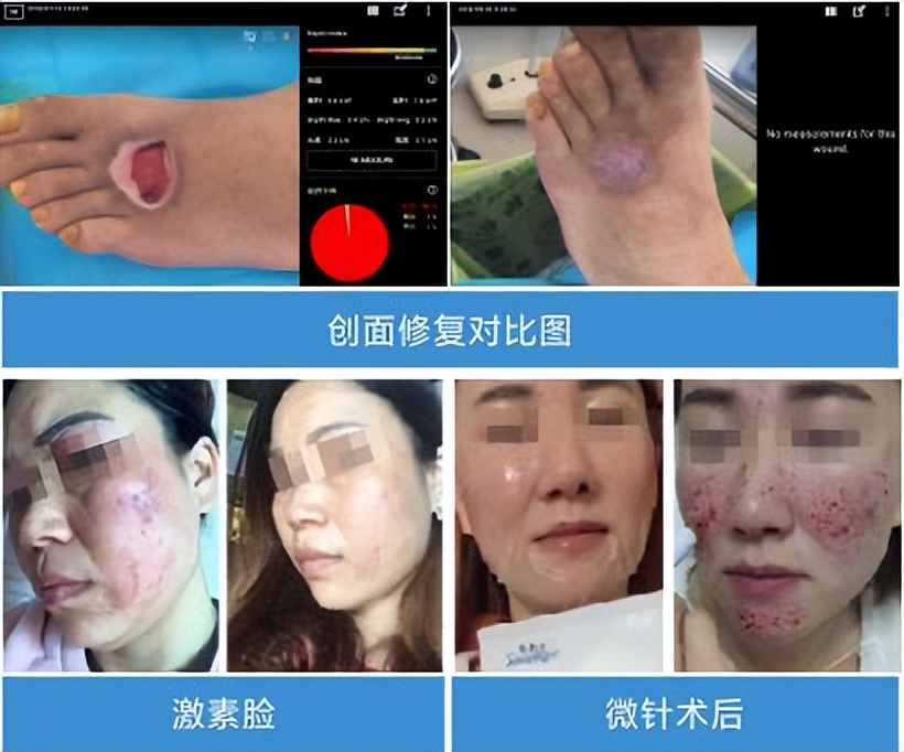 植美村护肤沙龙系列重磅上市,植美村的新品有哪些