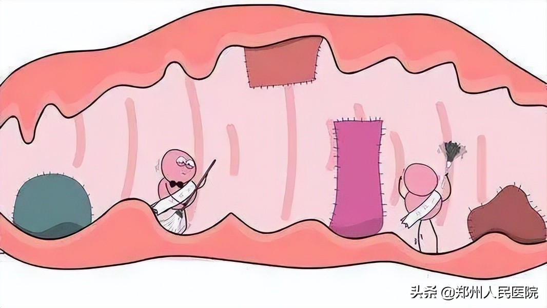 痒到痛不欲生！*处私**的这些尴尬如何解？