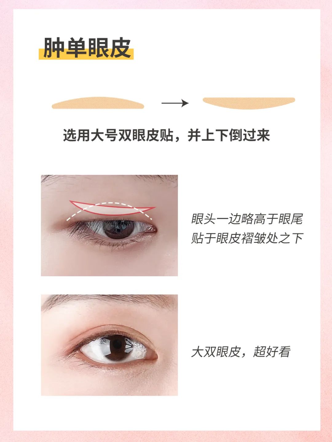 不同眼型的双眼皮贴贴法,各种眼型的双眼皮贴法详细教程