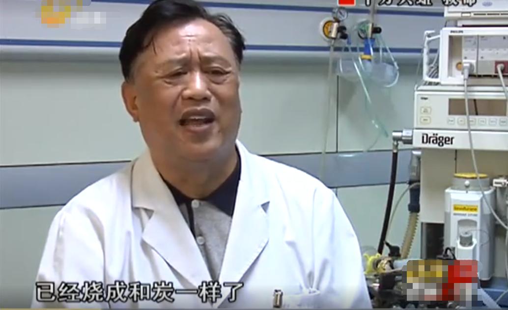 20岁小伙被重度烧伤七年后续,山东男子下肢被烧伤