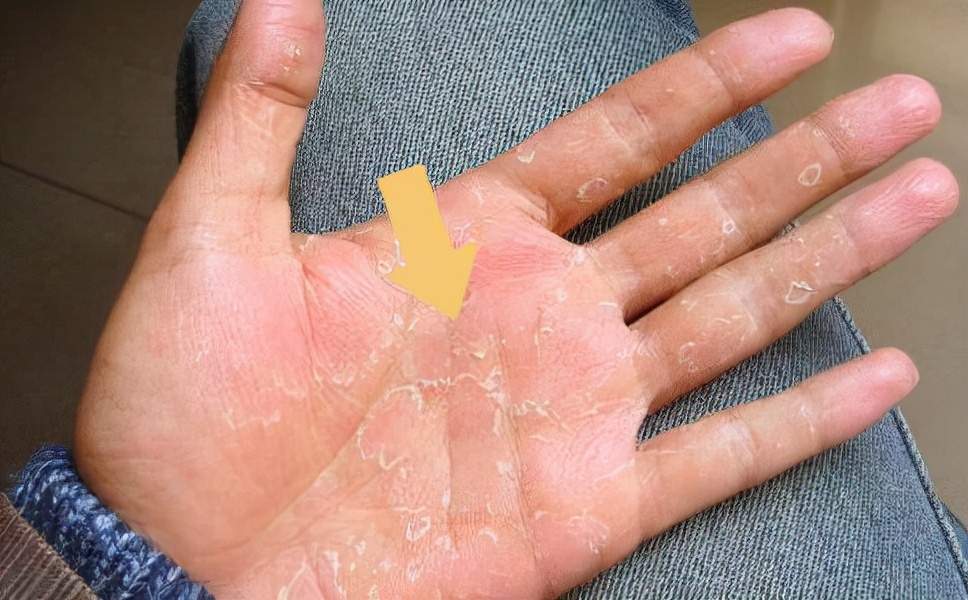 躺下睡觉嘴巴发干,晚上睡觉嘴巴发苦发干是怎么回事