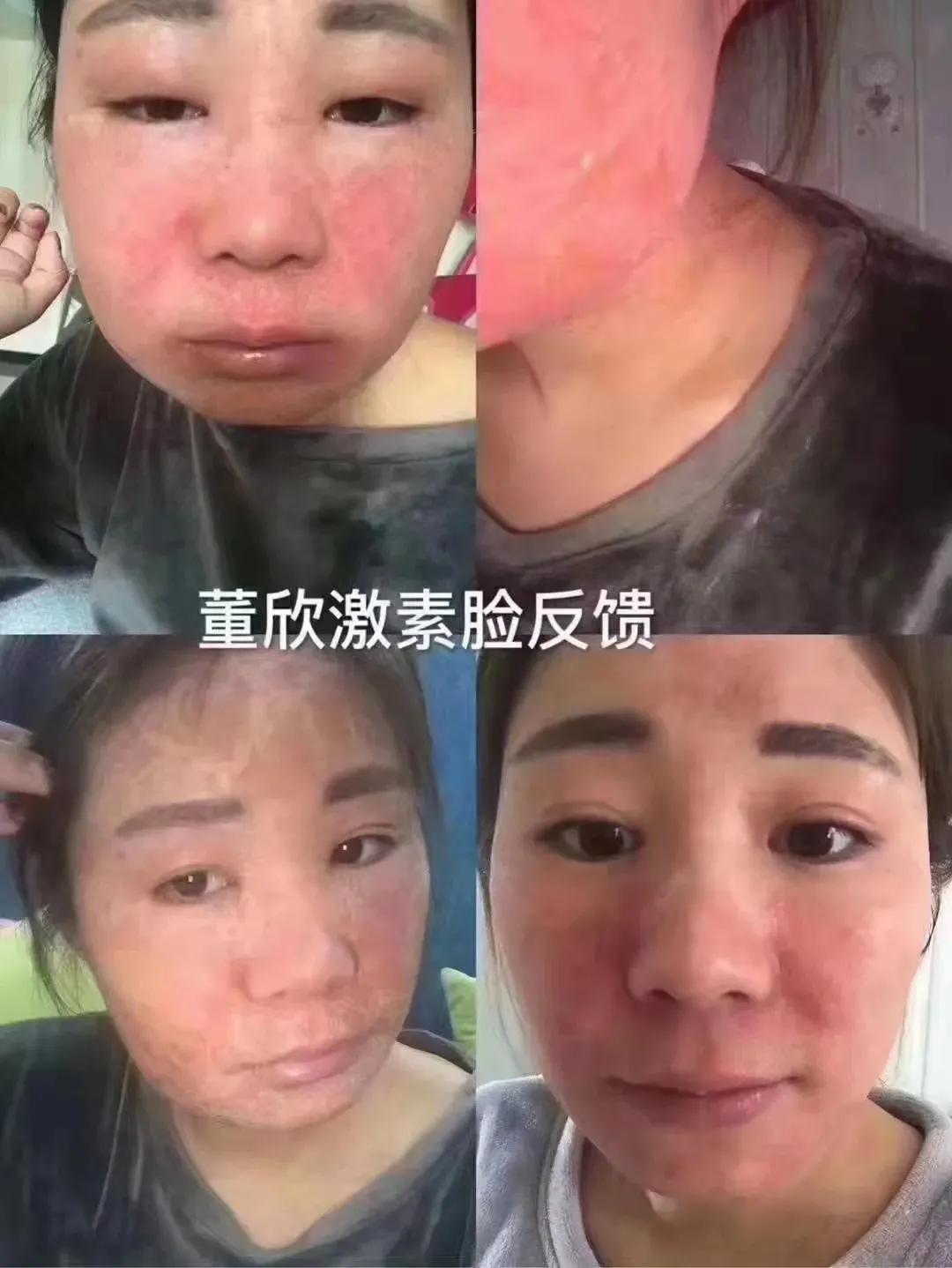 董欣护肤品哪个好用,董欣护肤品推荐