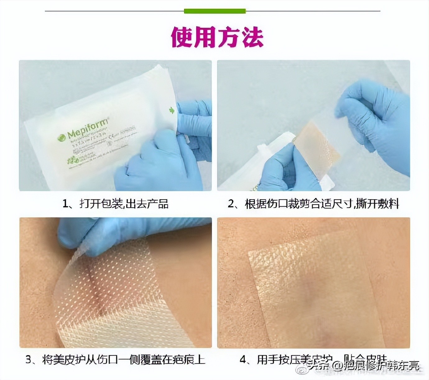 疤痕美皮护怎么搭配使用,疤痕修复护理适合吃什么