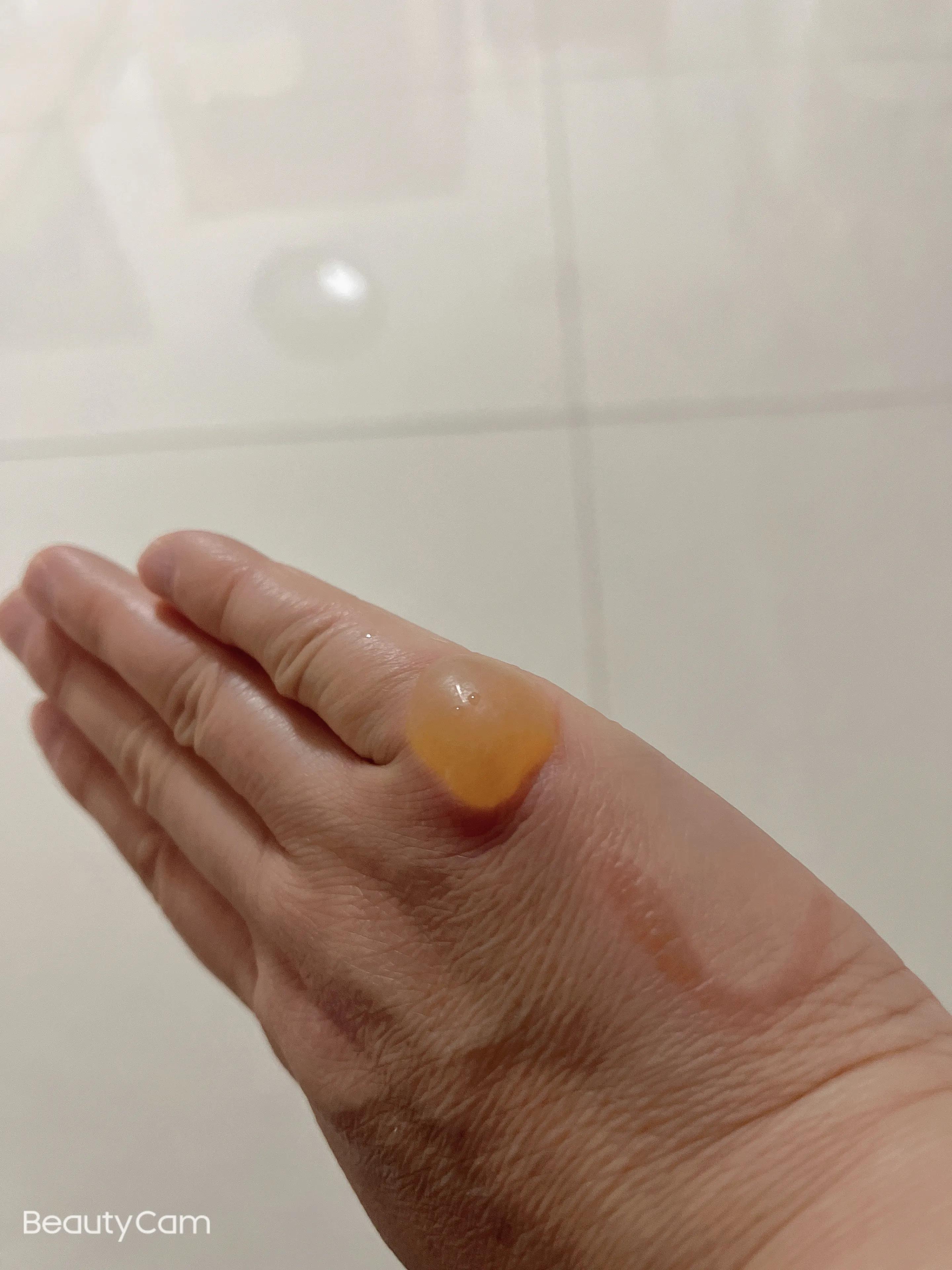 手被烫后起了一个大泡,手被烫个大泡