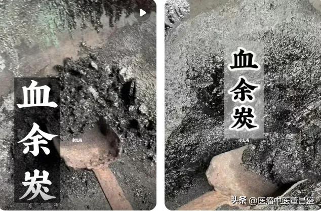 国医邓铁涛治肝良方,老中医治血崩秘方