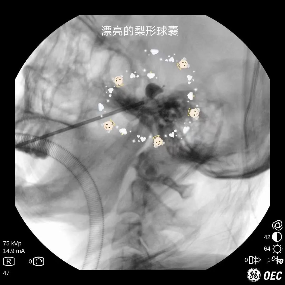 临汾治疗三叉神经痛多少钱,临汾市最好的三叉神经痛医院