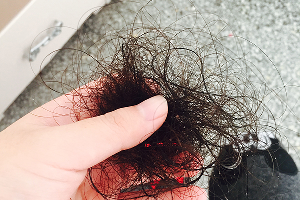 每天洗头发会导致脱发吗,每次洗头头发都掉一大把该怎么办